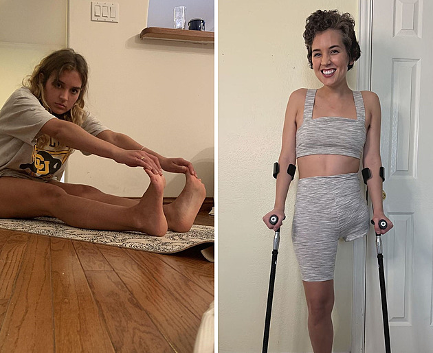 Na bolesti jí radili cvičení, nakonec žena skončila s amputovanou nohou